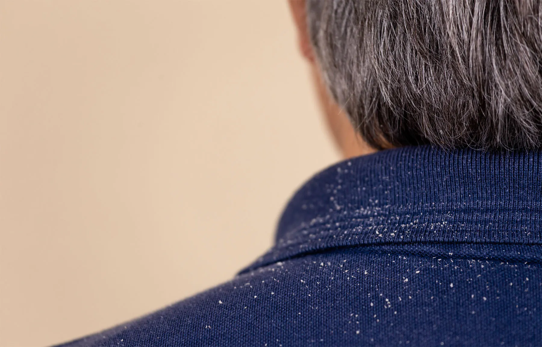 Como Criar Shampoos para Atender as Necessidades do Couro Cabeludo Sensível